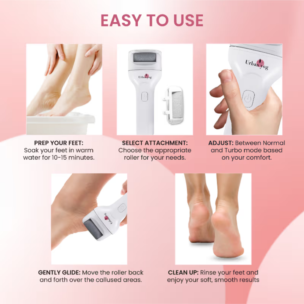UrbanYog Electric Callus Remover