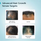 Pilgrim 3% Redensyl & 4% Anagain Advance Hair Growth Serum Roll-On With Rosemary & Korean Black Rice