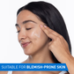 CeraVe Resurfacing Retinol Serum, Reduces Acne Marks with Licorice Root Extract & Niacinamide