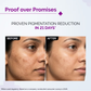 The Derma Co 2% Kojic Acid Face Serum for Dark spots reduction, Pigmentation & Blemishes