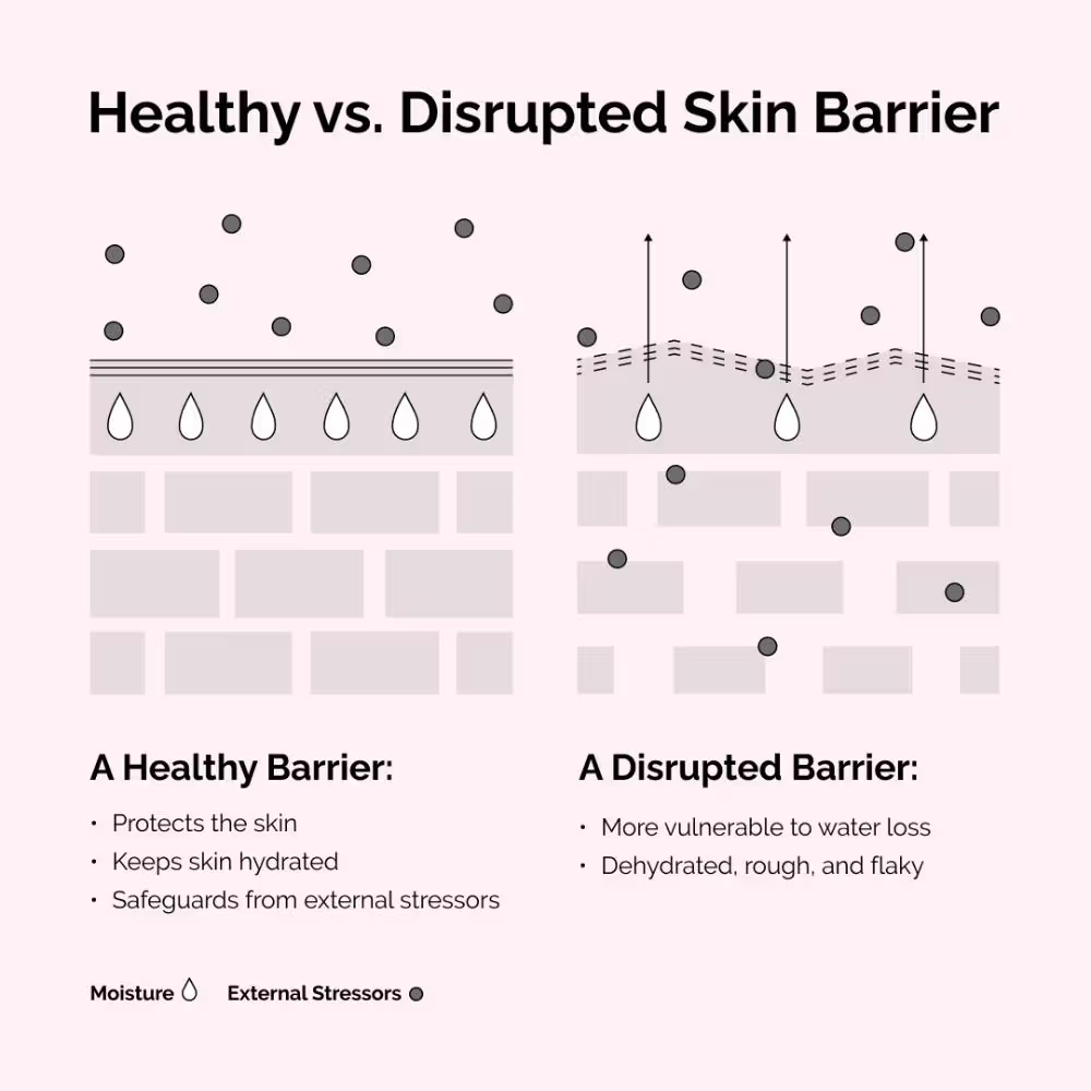 The Ordinary Soothing & Barrier Support Serum