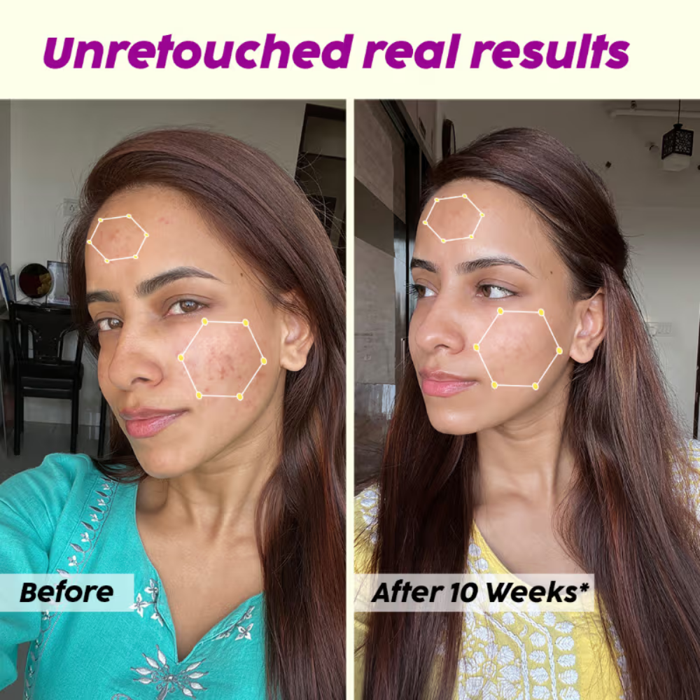 Plix Jamun Face Wash & Acne Marks Serum Combo