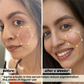 Plix 2% Alpha Arbutin Pineapple Serum for Pigmentation & Dark Spot Reduction