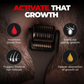 Beardo Beard Activator Derma Roller for Men, 540 - 0.5mm Chromium needles,Stimulates Hair Follicles