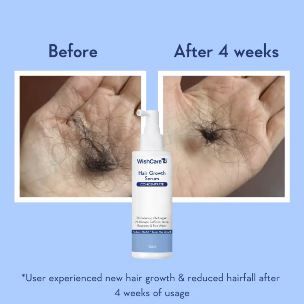 WishCare Hair Growth Serum Concentrate with Redensyl & Rosemary-In-Vivo Tested-Controls Hairfall
