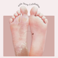 SeoulSkin Glycolic Acid Foot Peeling Mask