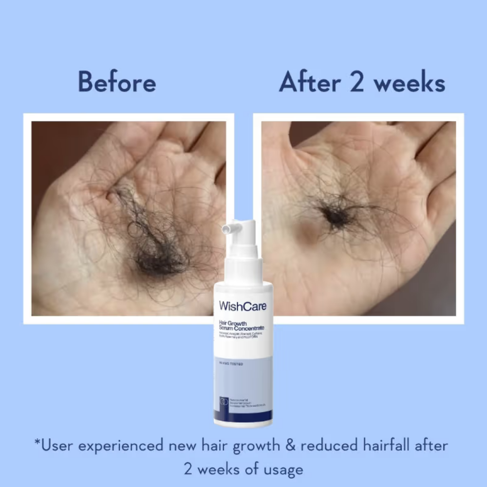 WishCare Hair Growth Serum Concentrate with Redensyl & Rosemary-In-Vivo Tested-Controls Hairfall