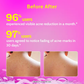 Chemist At Play 1% Salicylic Acid Acne Body Wash Shower Gel for Acne Control For Women & Men