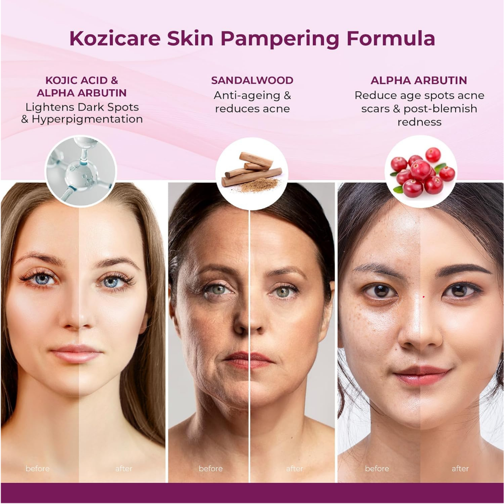 Kozicare Kojic Acid Cream | Real Sandalwood