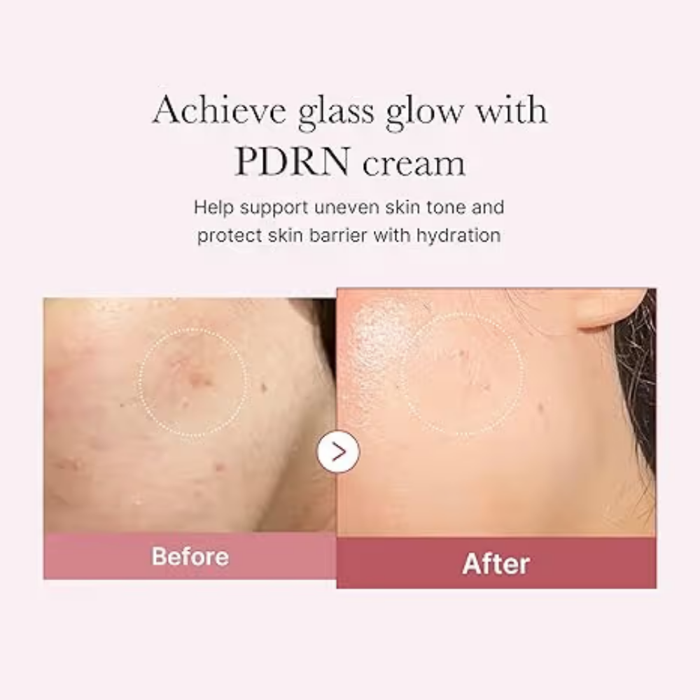 Medicube PDRN Pink Hyaluronic Moisturizing Cream