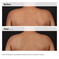 The Ordinary Salicylic Acid 0.5% Body Serum