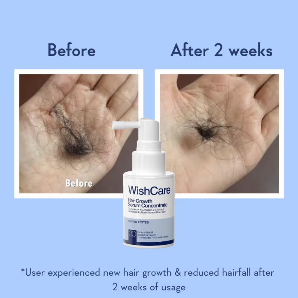 WishCare Hair Growth Serum Concentrate with Redensyl & Rosemary-In-Vivo Tested-Controls Hairfall