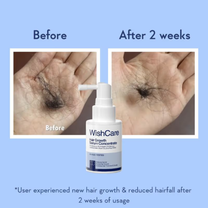 WishCare Hair Growth Serum Concentrate with Redensyl & Rosemary-In-Vivo Tested-Controls Hairfall