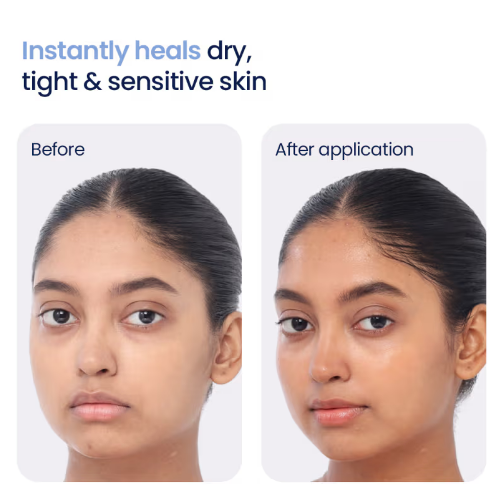 WishCare 3:1:1 Barrier Bounce Moisturizer for Dry & Sensitive Skin with Ceramides & Mung Mucin