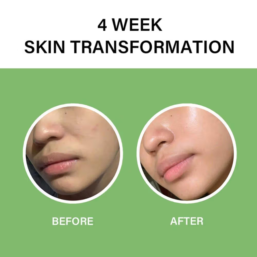 Celimax The Real Noni Energy Ampoule, Calming, Hydrating & Glow Boosting Face Serum