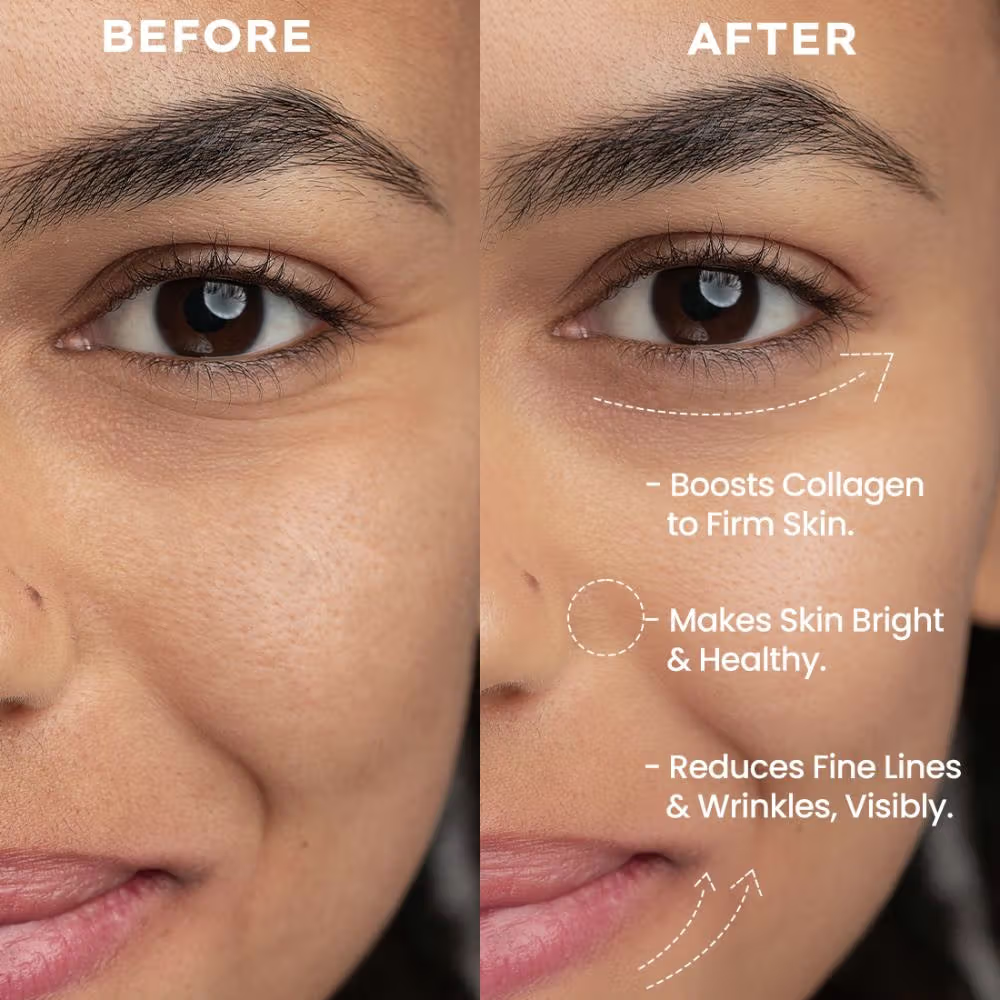 Hyphen 0.05% Retinal Reset, Retinol Derivative Serum for Anti Ageing, Reduces Fine Lines & Wrinkles