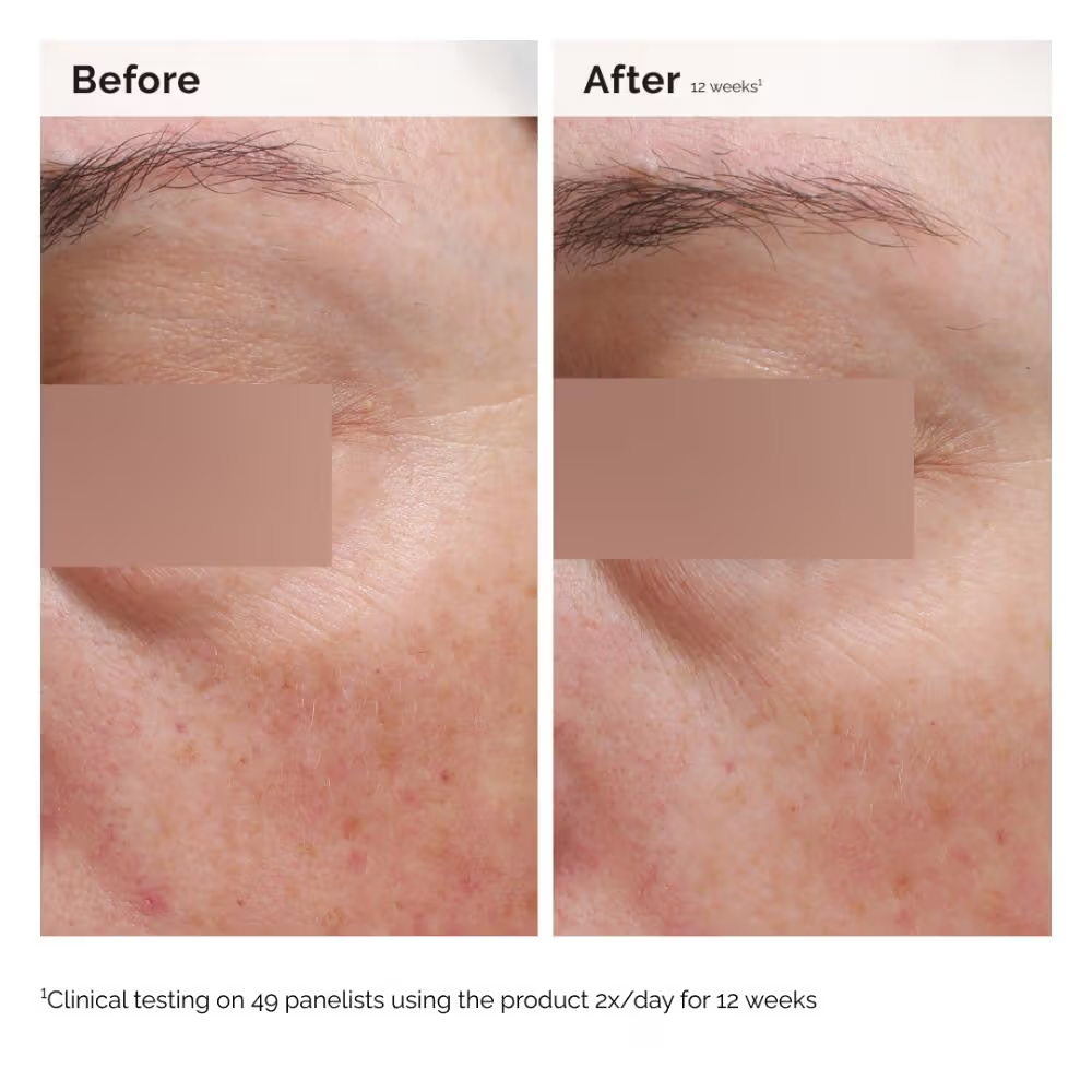 The Ordinary Niacinamide 5% Face & Body Emulsion