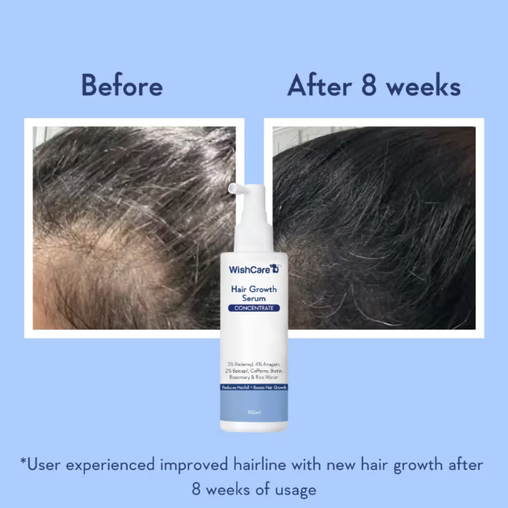 WishCare Hair Growth Serum Concentrate with Redensyl & Rosemary-In-Vivo Tested-Controls Hairfall