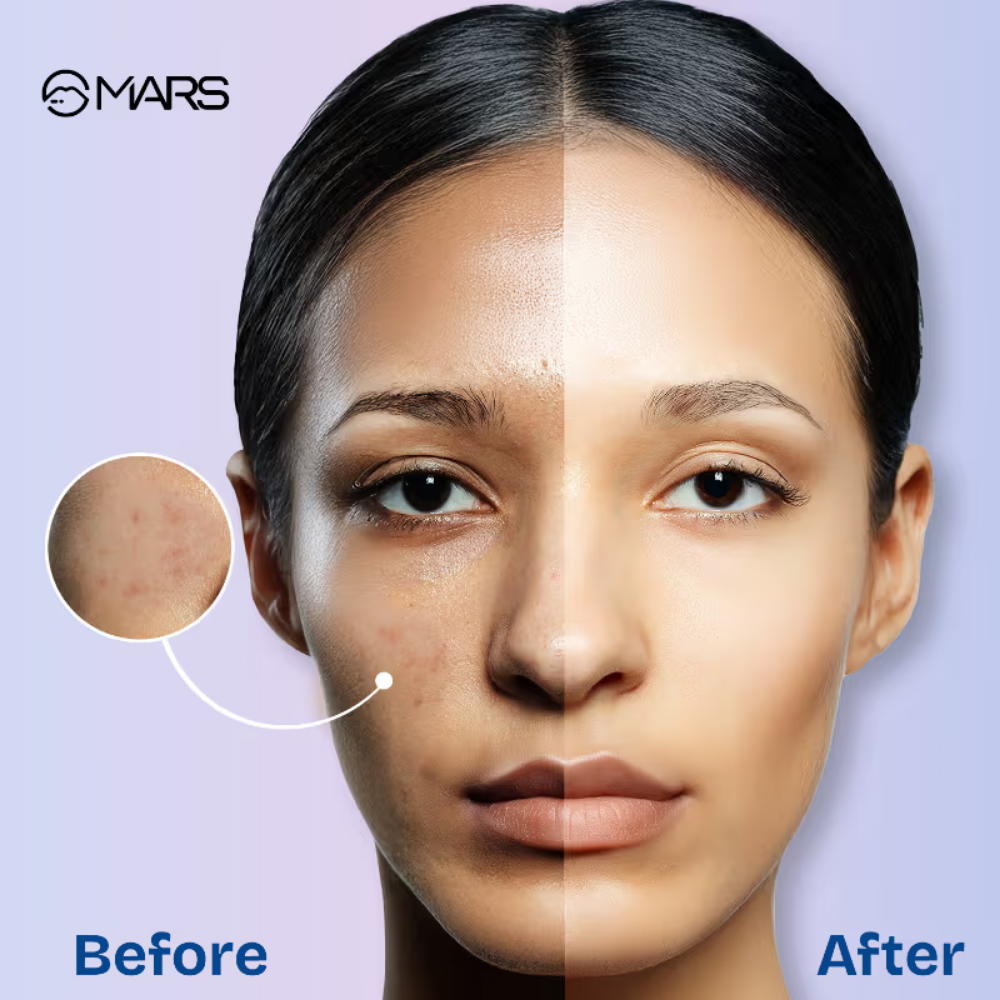 MARS Oil Blotter Gel Compact with Puff Applicator