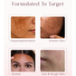 Seoulskin Kojic Acid Skin Lightening Cream
