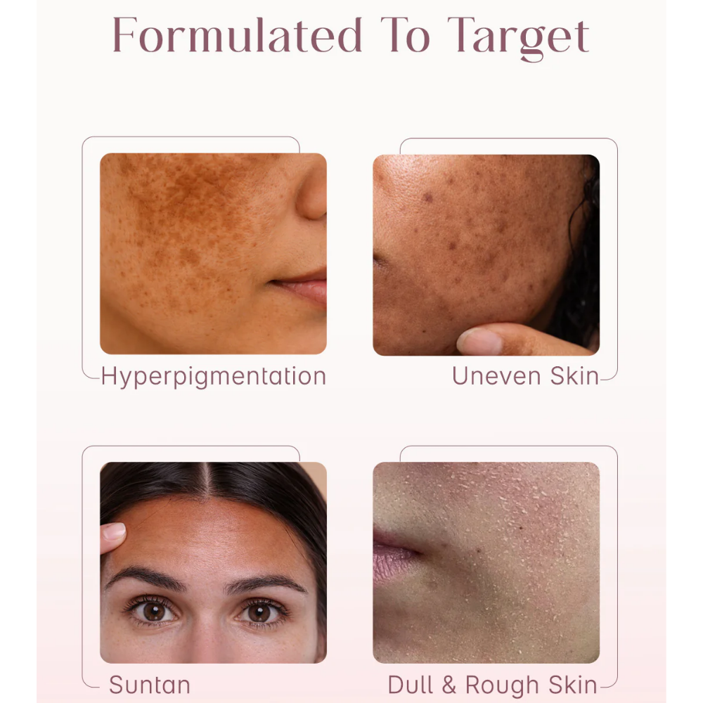 Seoulskin Kojic Acid Skin Lightening Cream
