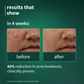 Plum SebaclearTM Mattifying Gel Crème With Matcha & Sebacic Acid