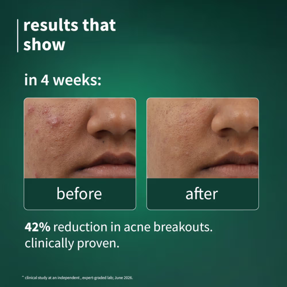 Plum SebaclearTM Mattifying Gel Crème With Matcha & Sebacic Acid