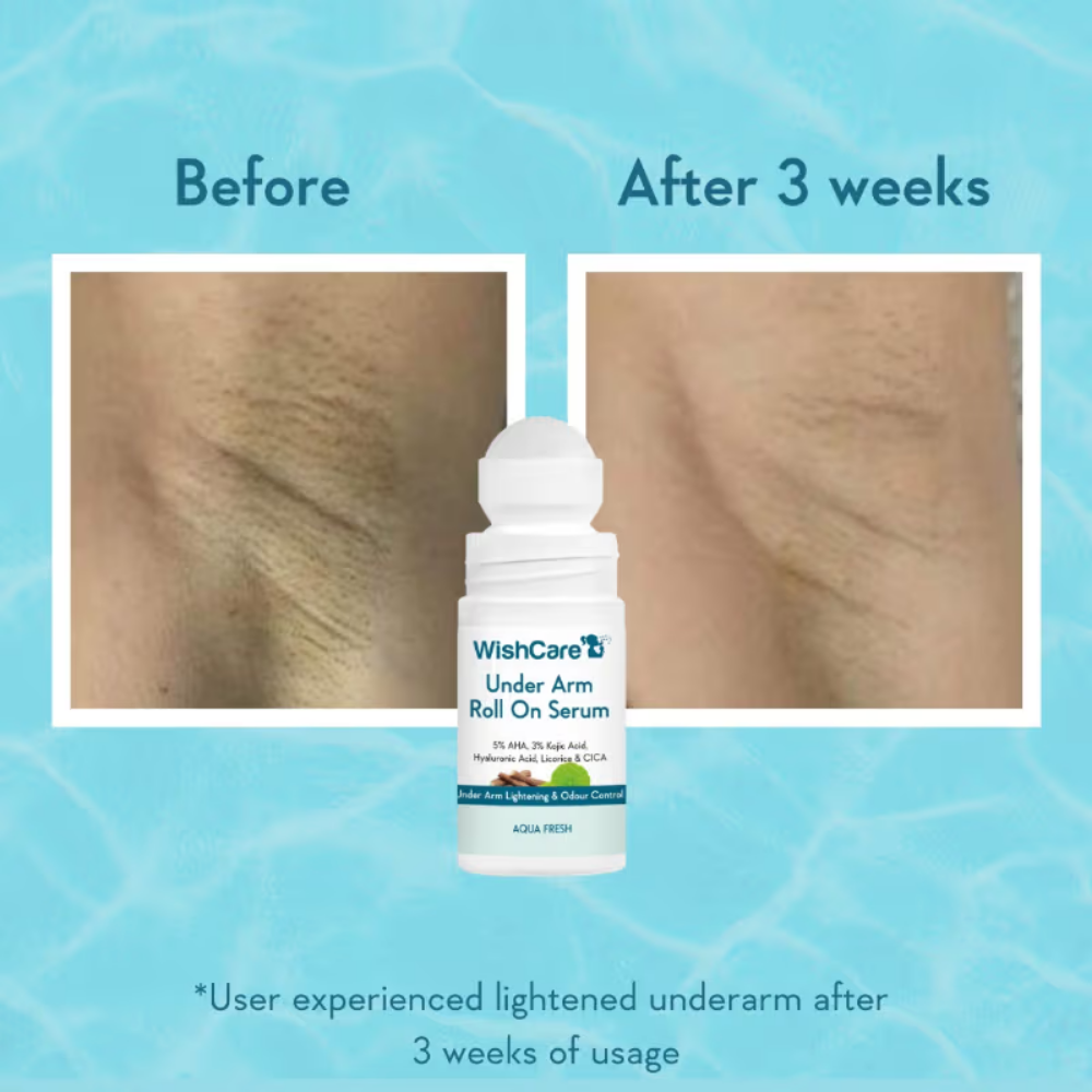 WishCare Aqua Fresh Underarm Roll On Serum-Reduces Pigmentation,Brightens Skin & Prevents Body Odour