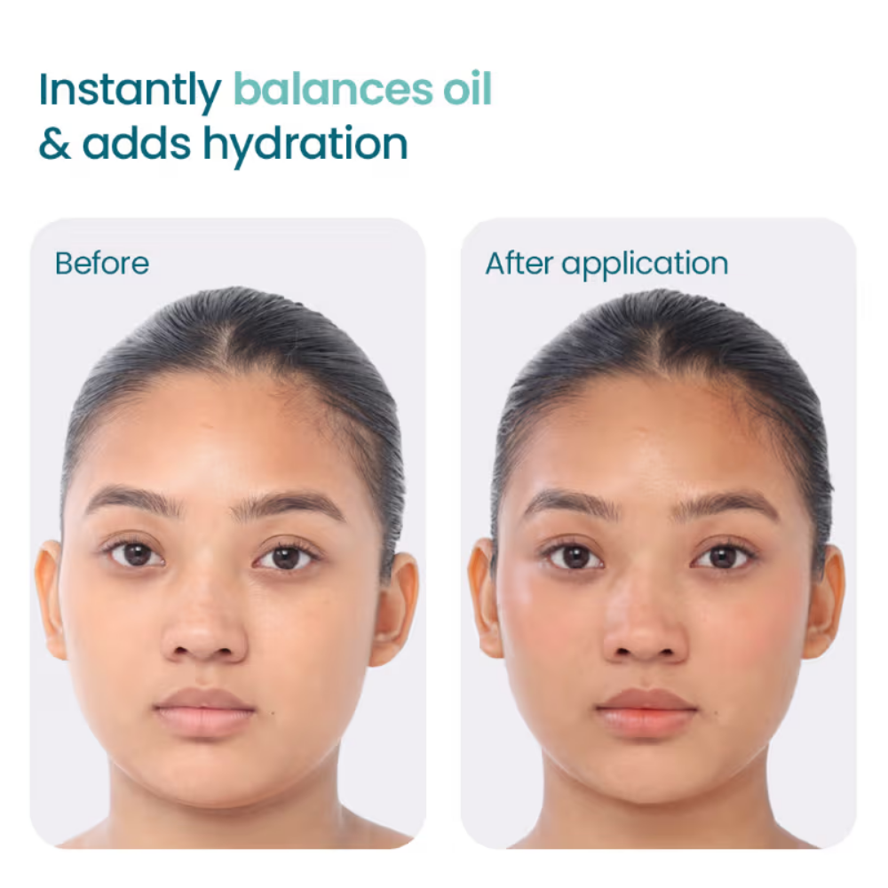 WishCare 2:1:3 NMF Oil Free Water Gel Moisturizer For Oily Skin with Niacinamide, Zinc PCA & Cica