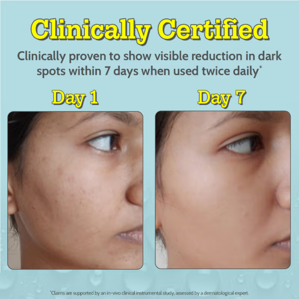 Chemist At Play 10% Vitamin C Face Serum |Brightens Skin |Treats Dark Spots & Hyperpigmentation