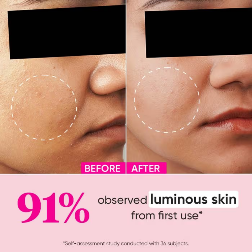 Dot & Key Watermelon + 10% Glycolic Gentle Exfoliating Face Serum, With Kojic, Controls Excess Oil