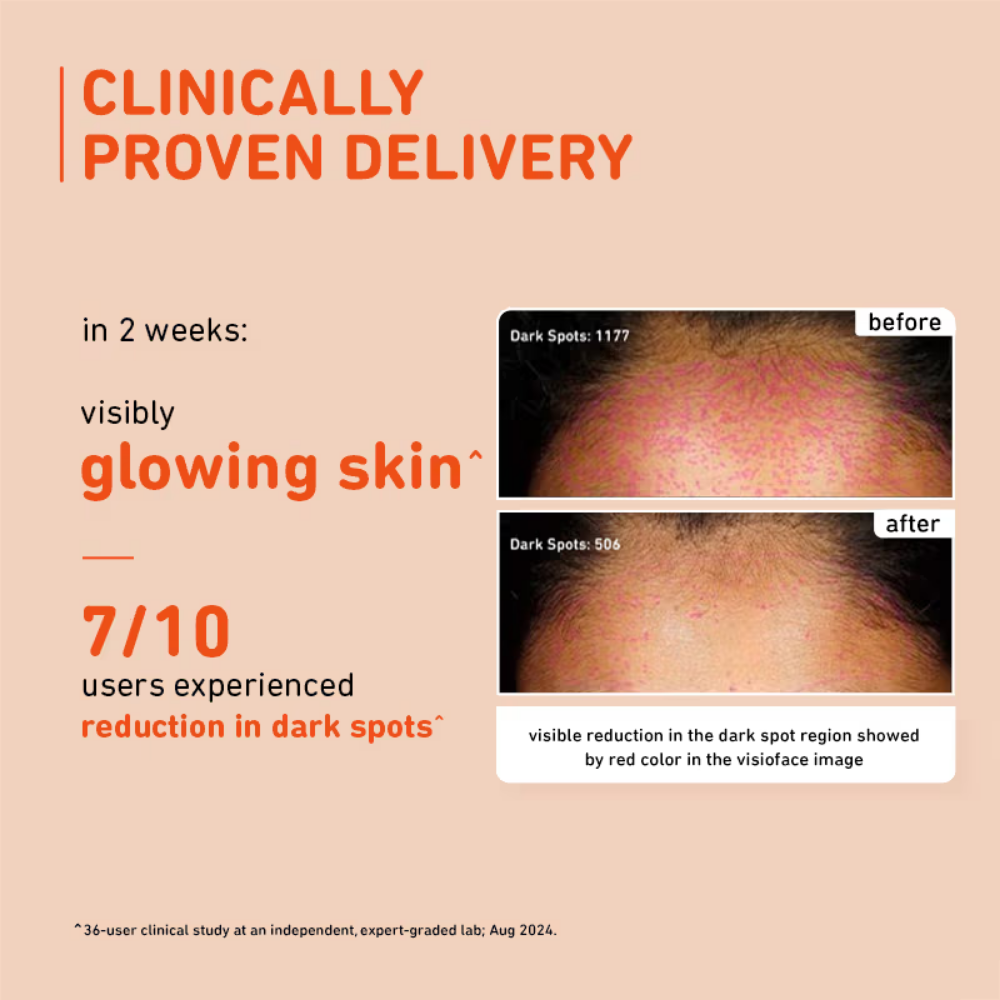 Plum Mandarin & 15% Vitamin C Glow Face Serum Dermat Tested To Fight Dark Spots & Dull Skin