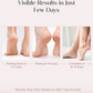 SeoulSkin Glycolic Acid Foot Peeling Mask