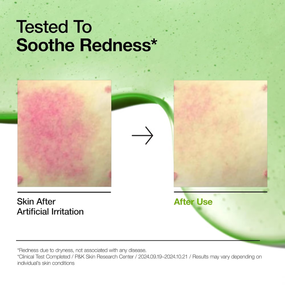 Anua Azelaic Acid 10 Hyaluron Redness Soothing Serum with Cica Soothes & Calms Acne-Prone Skin