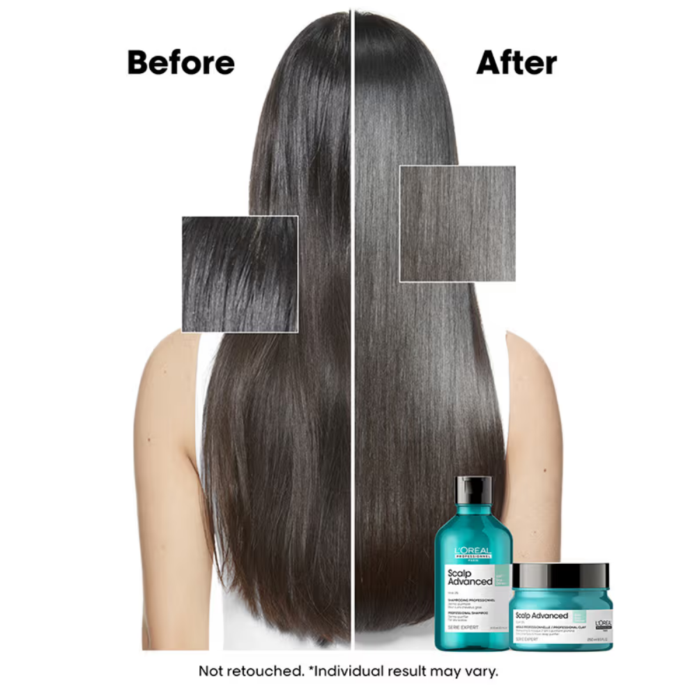 L’Oréal Professionnel Scalp Advanced Anti-Oiliness Shampoo for Oily Scalp, Less scalp sebum, 3% AHA