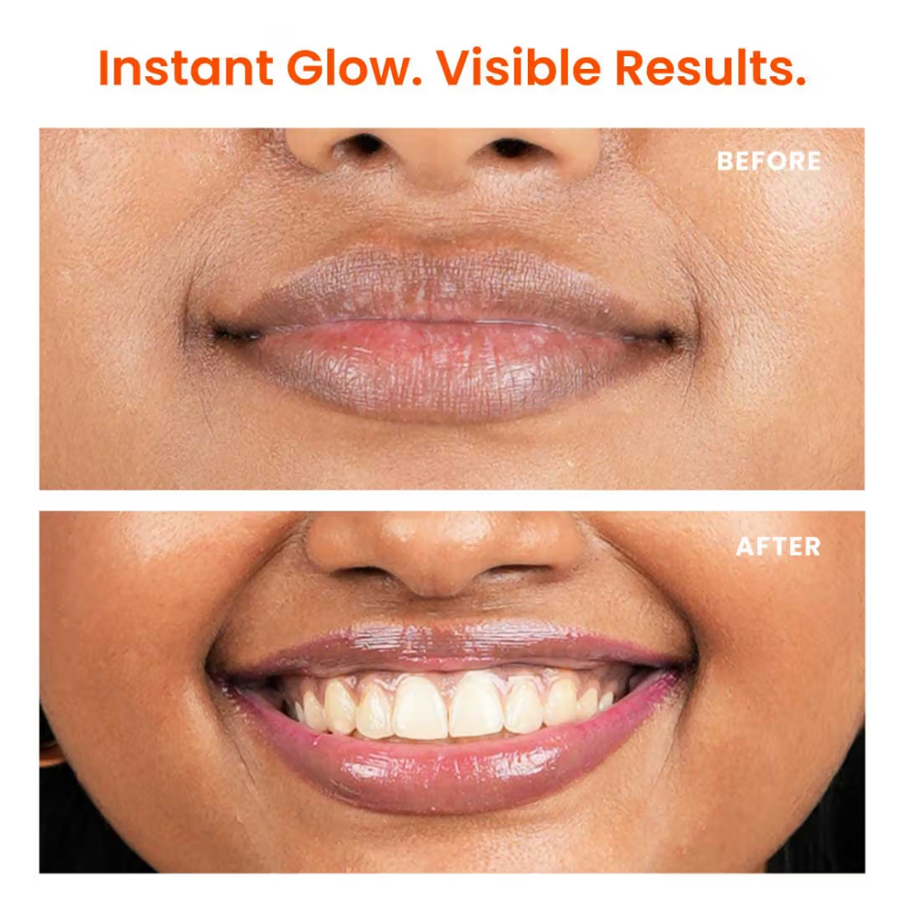 Foxtale Brightening Lip Balm