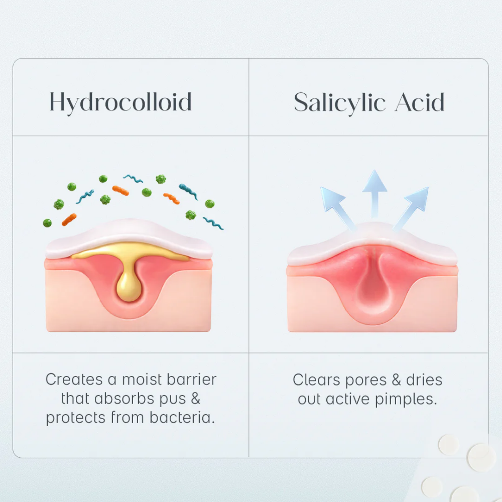 Seoulskin Acne Pimple Patch