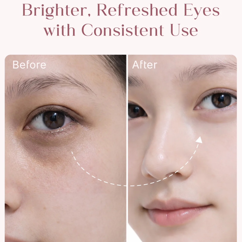 Seoulskin Under Eye Cream