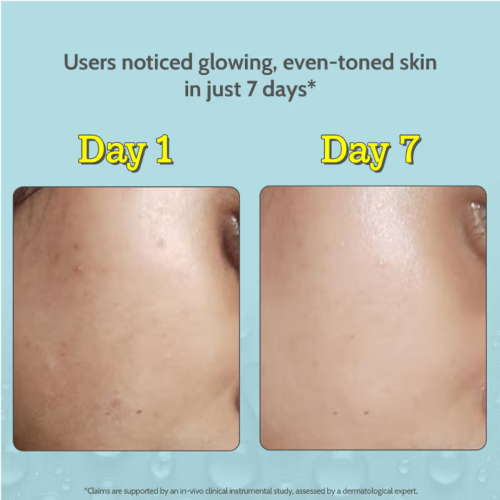 Chemist At Play 10% Vitamin C Face Serum |Brightens Skin |Treats Dark Spots & Hyperpigmentation