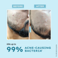 Hyphen Clarifying Acne Cleanser With 2% Salicylic Acid, Anti-Acne Face Wash For Oil Control