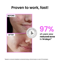 Foxtale 12% Niacinamide Serum