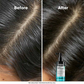 L'Oréal Professionnel Scalp Advanced 5-in-1 Professional Leave-in Serum for Scalp Care