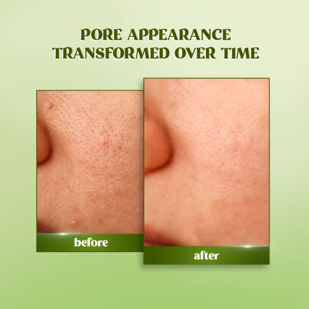 RENEE Matcha Face Toner