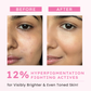 Hyphen Advanced De-Pigmentation Serum