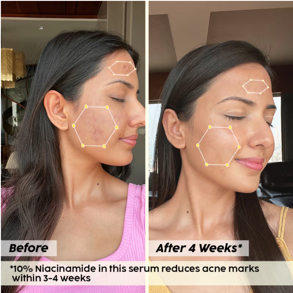 Plix 10% Niacinamide Jamun Face Serum