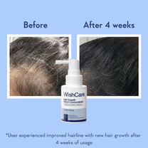 WishCare Hair Growth Serum Concentrate with Redensyl & Rosemary-In-Vivo Tested-Controls Hairfall