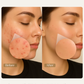 Seoulskin Snail mucin Micro needling serum 7500