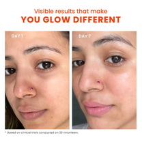 Foxtale Dewy Finish SPF 50 PA++++ Sunscreen For Dry Skin, Deeply Hydrates, In-Vivo Tested