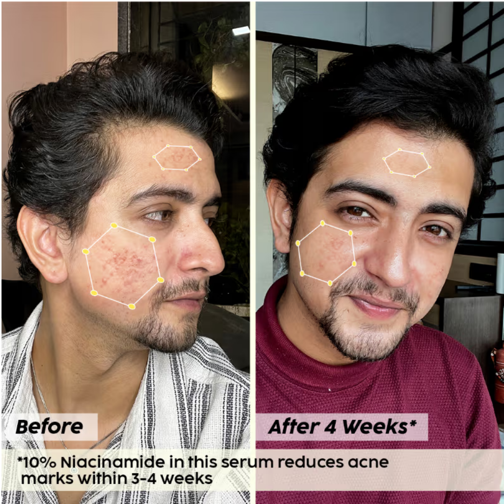 Plix 10% Niacinamide Jamun Face Serum