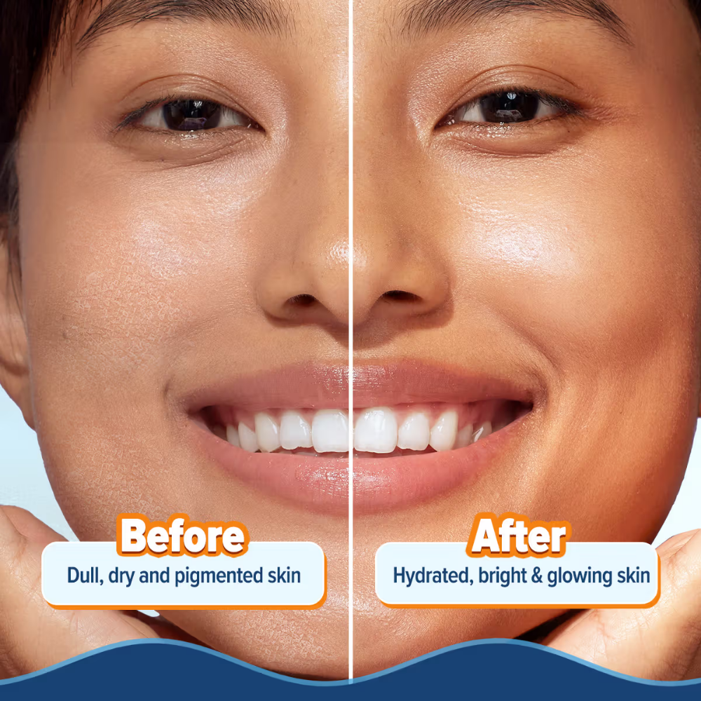 Aqualogica Glow+ Hydra Gel Moisturizer With Papaya & Vitamin C For 24 Hour Intense Hydration